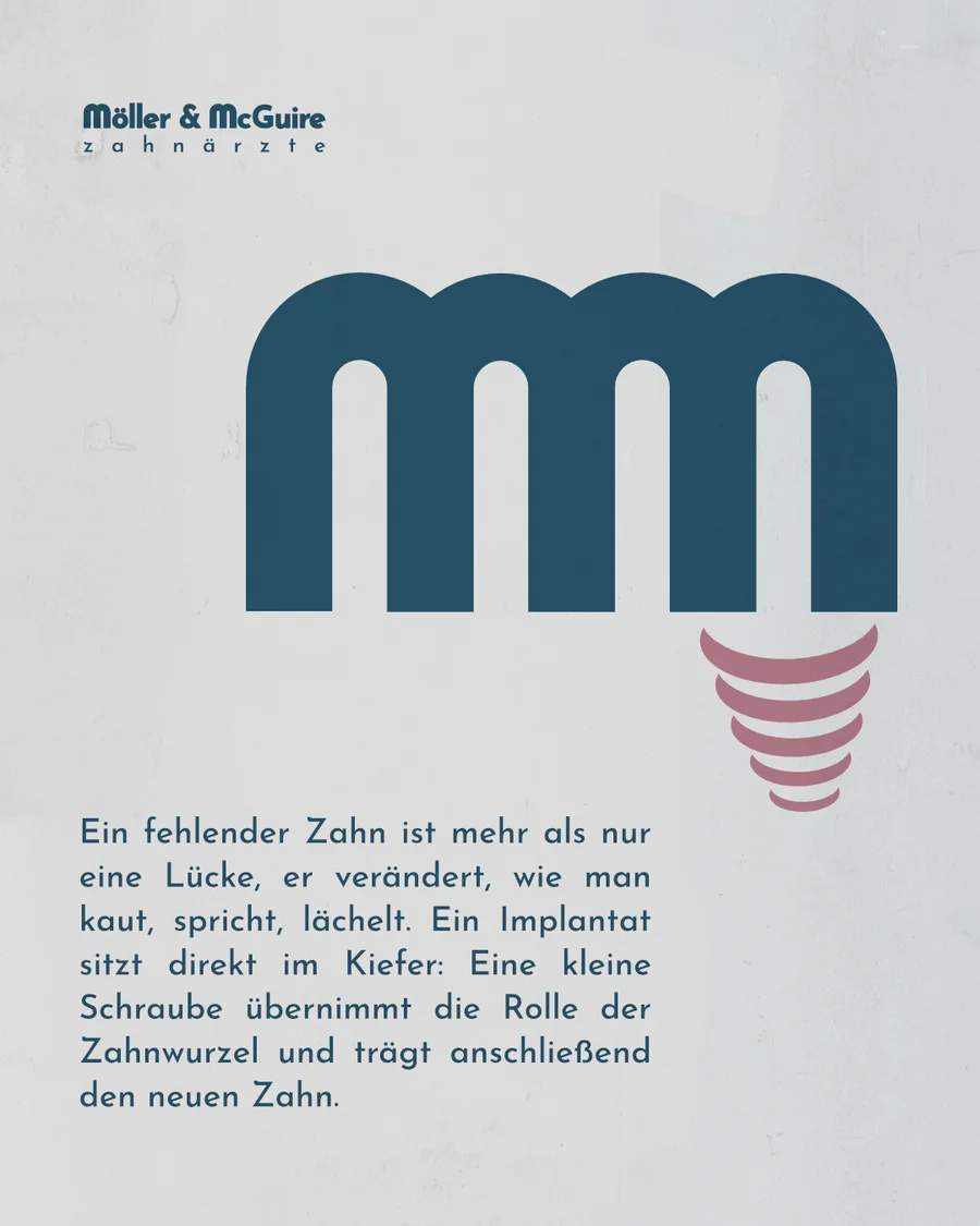 Implantat: Eine Titanschraube hängt unter dem Zeichen wie eine Wurzel.